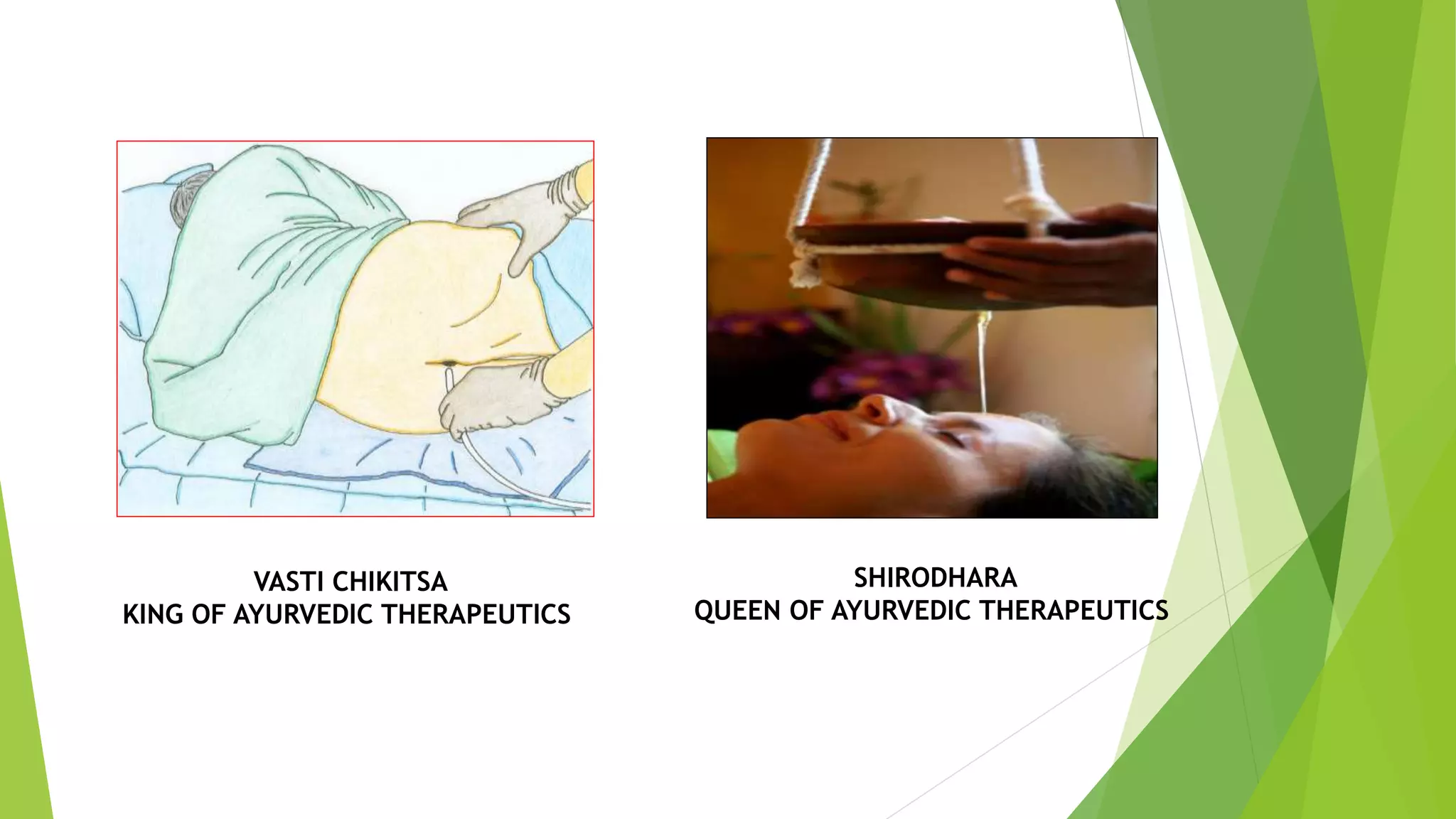 VASTI CHIKITSA
KING OF AYURVEDIC THERAPEUTICS
SHIRODHARA
QUEEN OF AYURVEDIC THERAPEUTICS
 