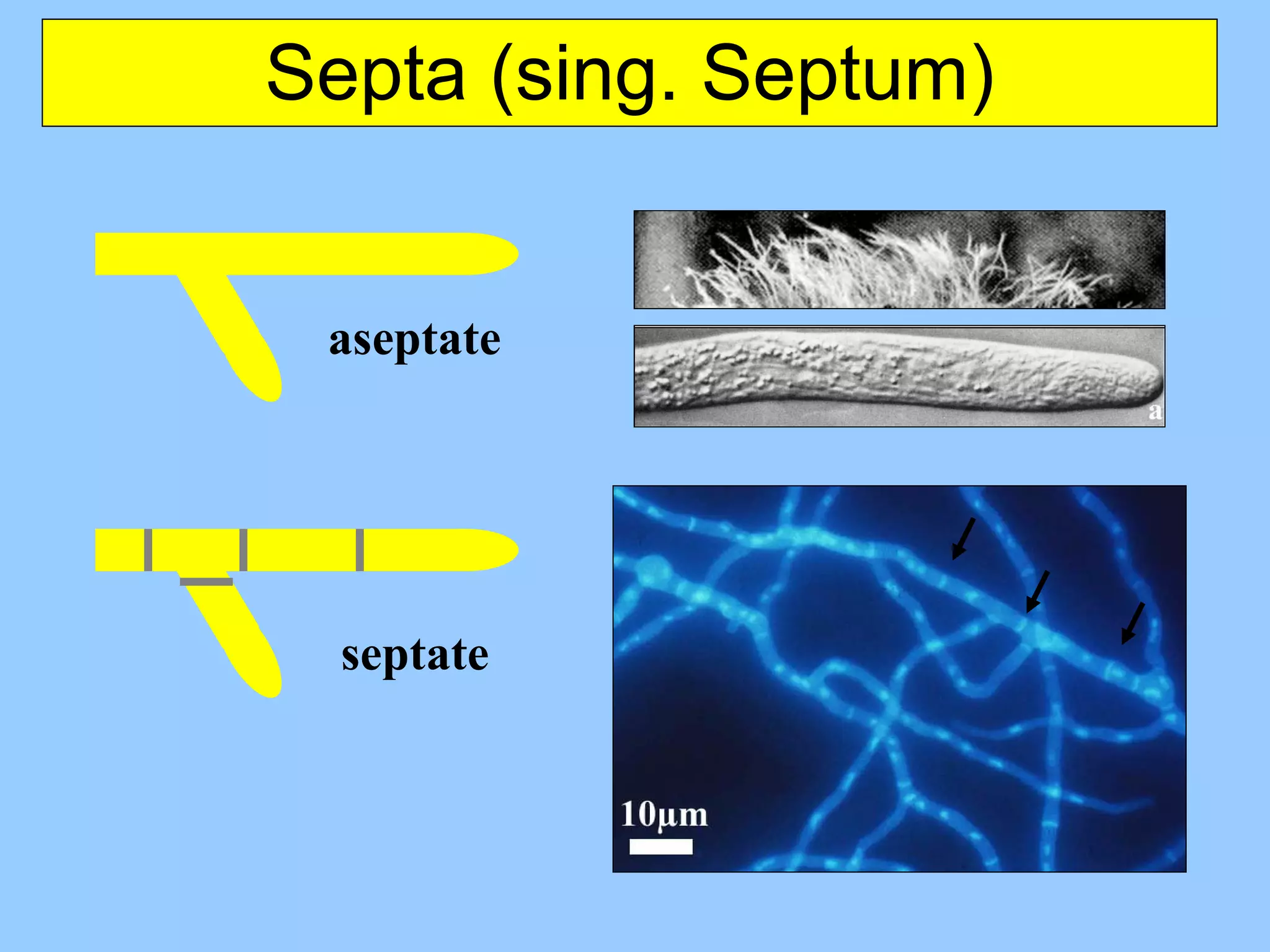 Septa (sing. Septum) aseptate septate 