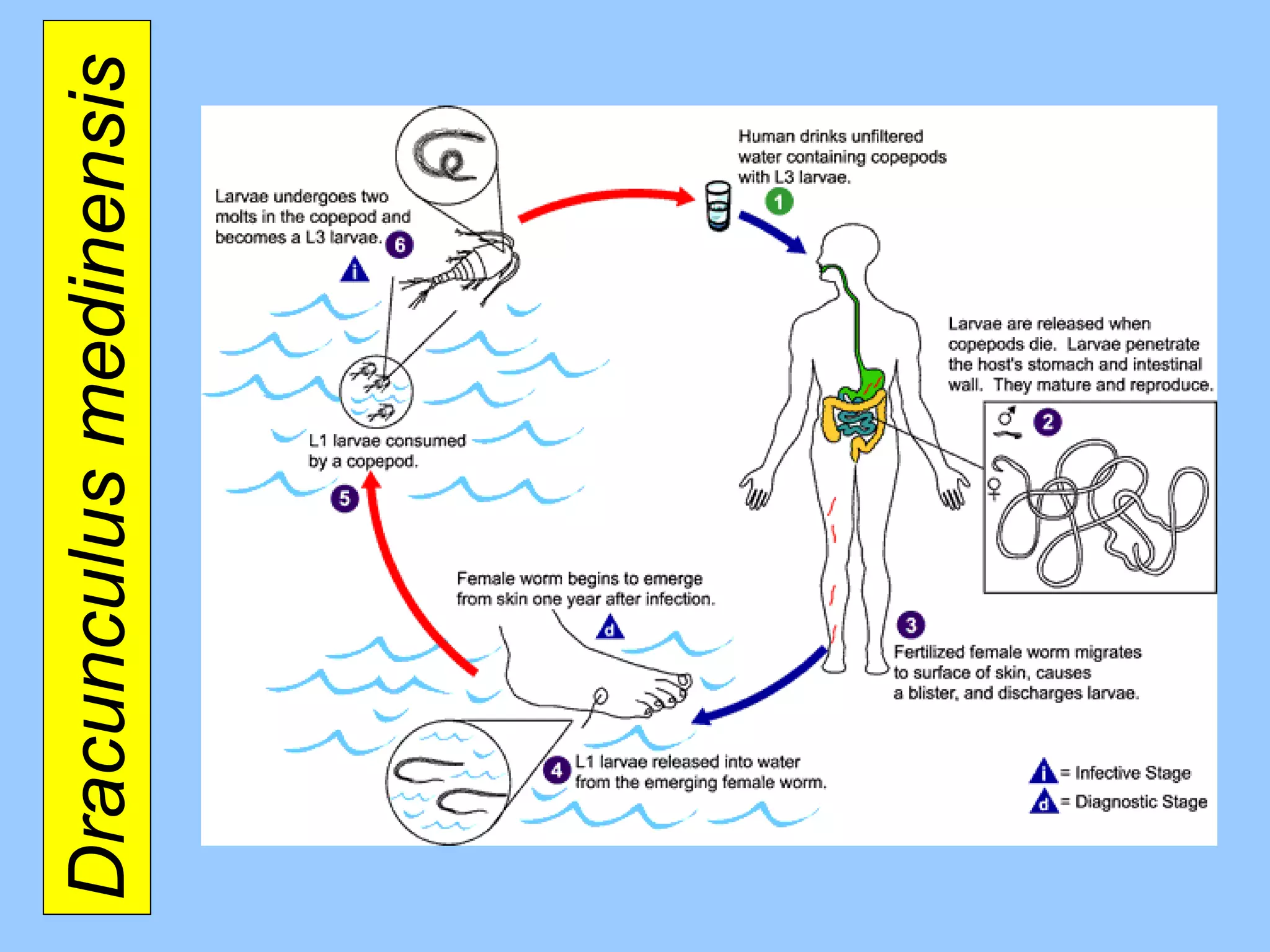 Dracunculus medinensis  
