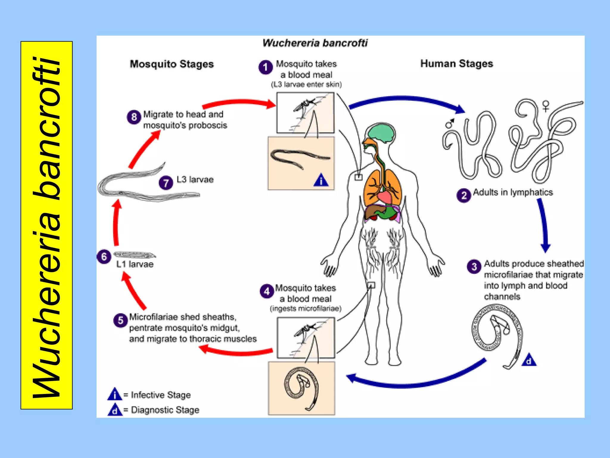 Wuchereria bancrofti  