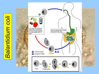 Balantidium coli  