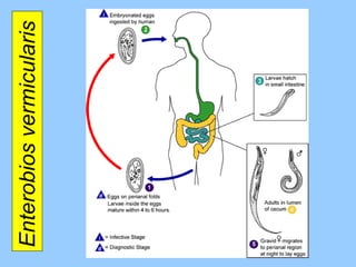 Enterobios vermicularis  