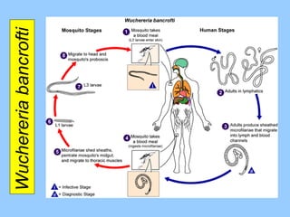 Wuchereria bancrofti  