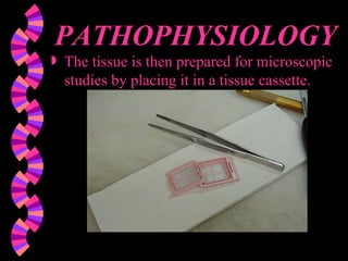 PATHOPHYSIOLOGY The tissue is then prepared for microscopic studies by placing it in a tissue cassette. 