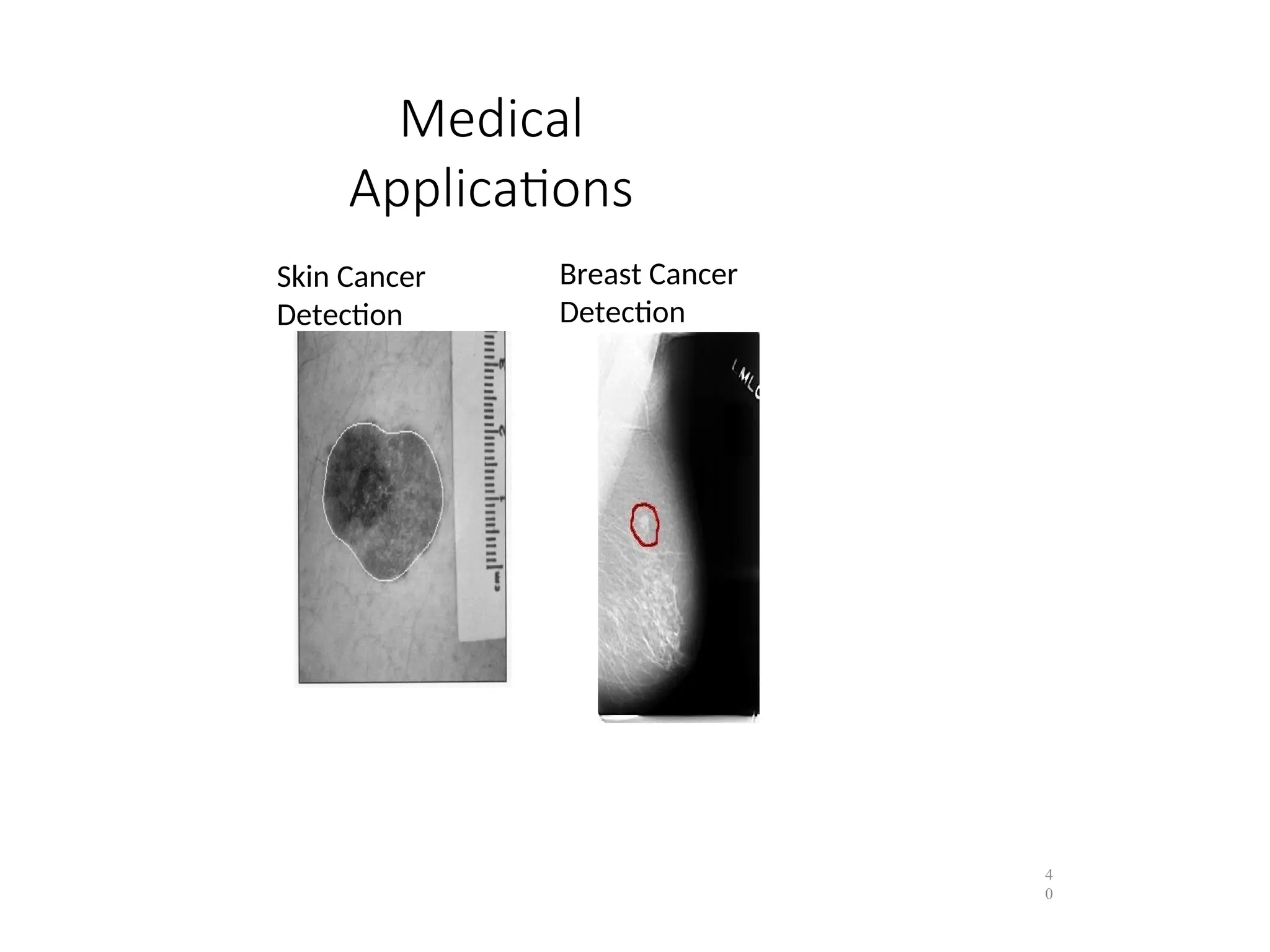 Medical
Applications
4
0
Skin Cancer
Detection
Breast Cancer
Detection
 