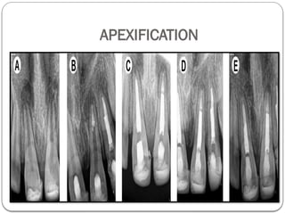 INTRODUCTION to Pediatric Dentistry.pptx