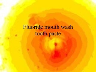 Fluoride mouth wash tooth paste 