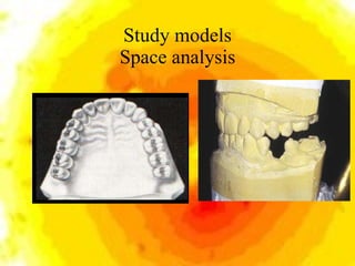 Study models Space analysis 