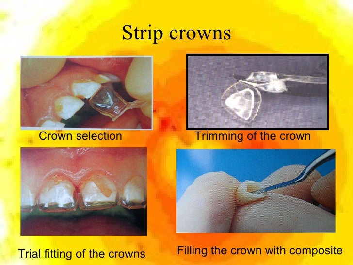 Introduction to pediatric dentistry 2009(new)