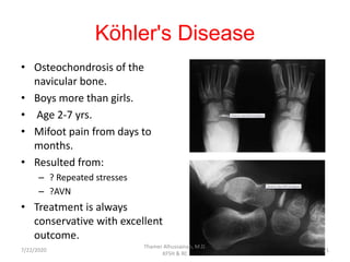 Köhler's Disease
• Osteochondrosis of the
navicular bone.
• Boys more than girls.
• Age 2-7 yrs.
• Mifoot pain from days to
months.
• Resulted from:
– ? Repeated stresses
– ?AVN
• Treatment is always
conservative with excellent
outcome.
7/22/2020
Thamer Alhussainan, M.D.
KFSH & RC
21
 