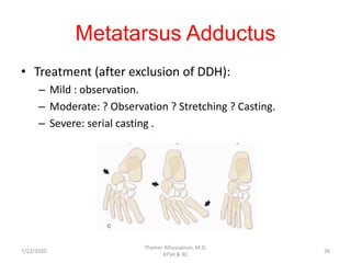 Metatarsus Adductus
• Treatment (after exclusion of DDH):
– Mild : observation.
– Moderate: ? Observation ? Stretching ? Casting.
– Severe: serial casting .
7/22/2020
Thamer Alhussainan, M.D.
KFSH & RC
26
 
