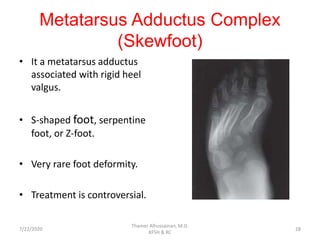 Metatarsus Adductus Complex
(Skewfoot)
• It a metatarsus adductus
associated with rigid heel
valgus.
• S-shaped foot, serpentine
foot, or Z-foot.
• Very rare foot deformity.
• Treatment is controversial.
7/22/2020
Thamer Alhussainan, M.D.
KFSH & RC
28
 
