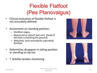 Flexible Flatfoot
(Pes Planovalgus)
• Clinical evaluation of flexible flatfoot is
not accurately defined.
• Assessment on standing position:
– Hindfoot valgus.
– Depressed or absent foot arch (head of
the talus is touching the ground).
– Abducted (and secondarily supinated)
forefoot.
• Deformities disappear in sitting position
or standing on tip toe.
• ? Achilles tendon shortening
7/22/2020
Thamer Alhussainan, M.D.
KFSH & RC
32
 