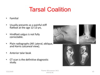 Tarsal Coalition
• Familial
• Usually presents as a painful stiff
flatfoot at the age 12-13 yrs.
• Hindfoot valgus is not fully
correctable.
• Plain radiographs (AP, Lateral, oblique,
and Harris calcaneal view).
• Anterior talar beak
• CT scan is the definitive diagnostic
study.
7/22/2020
Thamer Alhussainan, M.D.
KFSH & RC
43
 
