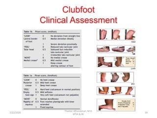 Clubfoot
Clinical Assessment
7/22/2020
Thamer Alhussainan, M.D.
KFSH & RC
59
 