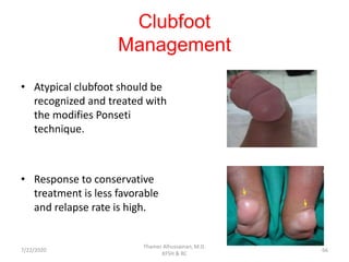 Clubfoot
Management
• Atypical clubfoot should be
recognized and treated with
the modifies Ponseti
technique.
• Response to conservative
treatment is less favorable
and relapse rate is high.
7/22/2020
Thamer Alhussainan, M.D.
KFSH & RC
66
 
