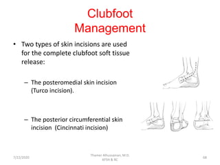 Clubfoot
Management
• Two types of skin incisions are used
for the complete clubfoot soft tissue
release:
– The posteromedial skin incision
(Turco incision).
– The posterior circumferential skin
incision (Cincinnati incision)
7/22/2020
Thamer Alhussainan, M.D.
KFSH & RC
68
 