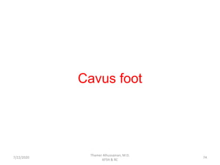Cavus foot
7/22/2020
Thamer Alhussainan, M.D.
KFSH & RC
74
 