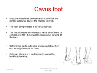 Cavus foot
• Muscular imbalance between tibialis anterior and
peroneus longus causes the first ray to drop.
• The heel compensates in to varus position.
• The toe extensors will overact as ankle dorsiflexors to
compensate for Tib.Ant weakness causing clawing of
the toes
• Deformities starts as flexible and correctable, then
end as a rigid non correctable.
• Coleman block test is performed to assess the
hindfoot flexibility.
7/22/2020
Thamer Alhussainan, M.D.
KFSH & RC
77
 