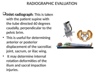 Internal Ilium Rotation INTRODUCTION TO PELVIC INJURIES - Detailed pptx | PPTX