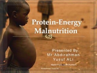 Presented By :
Mr:Abdirahman
Yusuf ALi.
Master Public health(Nutrition)
Abdirahman Yusuf Ali
1
 