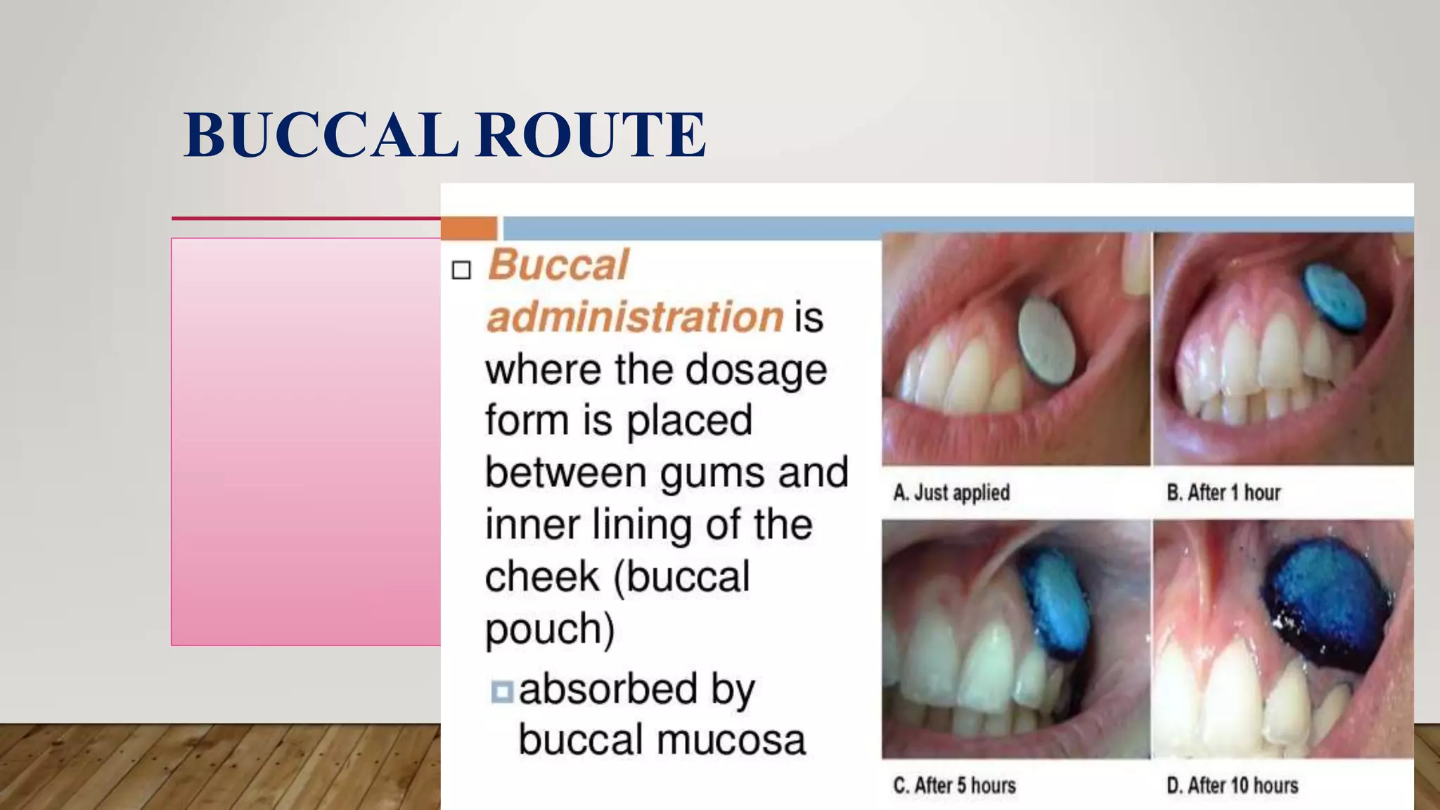 BUCCAL ROUTE
 