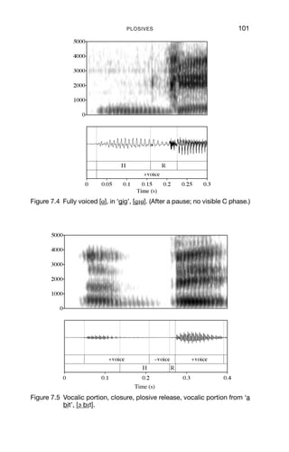 100                       AN INTRODUCTION TO ENGLISH PHONETICS

                                            C      H       R




                                                    Time
                                                    Time

                 Fully voiced
                       v
 Partially voiced, e.g. [b d ]
                         b
       Voiceless, unaspirated
       Voiceless, unaspirated
        o
         Voiceless, aspirated
         Voiceless, aspirated
          o
      Voiceless, preaspirated
      Voiceless, preaspir
       o                rated

Figure 7.3 Voicing for plosives. Dotted line = voicing. The upper lines
           represent two articulators moving together and apart again.

starts after release, VOT is said to be positive, while if it starts before
release, it is said to be negative.

7.3.1 Fully voiced plosives
In fully voiced plosives, modal vocal fold vibration continues through all
phases of the plosive.
   Make a fully voiced plosive by producing a vowel, e.g. [ɑ], and then
make a closure at the lips while continuing to say the vowel. This results
in a closure with a low-pitched (and quiet) buzzing sound. For the vocal
folds to vibrate, there needs to be a difference in pressure above and
below the glottis. With a complete oral closure, eventually the pressure
above and below the glottis equalises, because the air above the glottis
has no means of escape. Therefore the duration of a fully voiced closure
is constrained by how long a pressure difference across the glottis can
be maintained. If the closure is released as soon as the voicing stops, a
fully voiced plosive is produced. Fully voiced plosives commonly occur
between two voiced sounds, as in ‘hobby’, ‘under’, ‘hunger’, and in some
(but by no means all) varieties they are normal productions of [b d ].

7.3.2 Partially voiced plosives
If preceded by a voiced sound, the sounds [b d ] in English are gener-
ally partially voiced: voicing continues during the early part of the
closure but then ceases part way through the hold phase. On release,
voicing starts again almost immediately.
   An example of this is shown in Figure 7.5, which contains [b] between
two vowels. Voicing stops half way through the hold phase, and starts
again immediately after the release of the closure.
   Utterance-ﬁnal [b d ] are often partially voiced, and have no voicing,
or whispery voice, on release; this can be transcribed as [b d ].
 