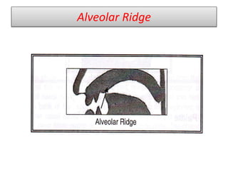 Alveolar Ridge
 