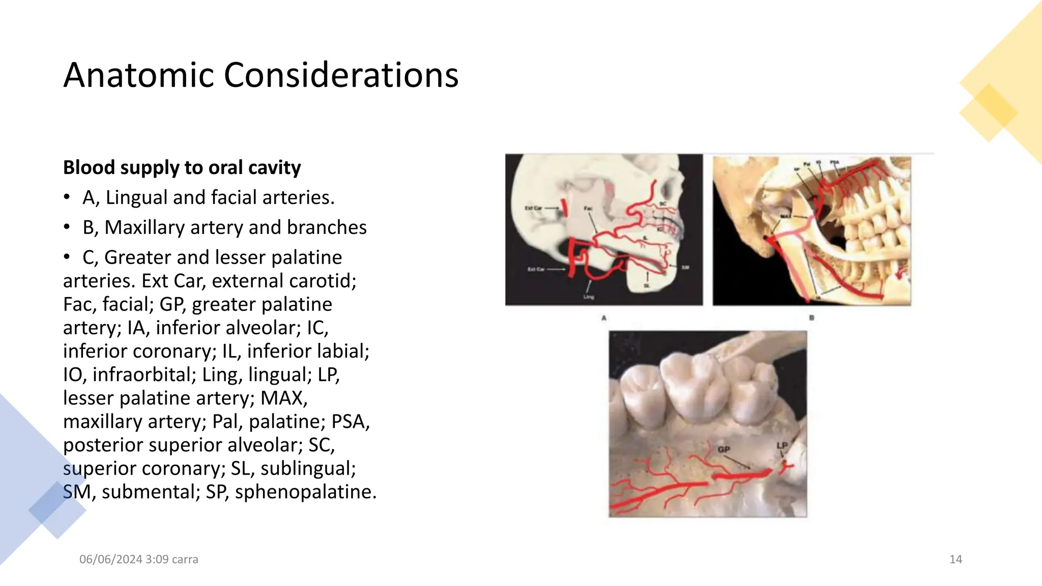 Anatomic Considerations
Blood supply to oral cavity
• A, Lingual and facial arteries.
• B, Maxillary artery and branches
• C, Greater and lesser palatine
arteries. Ext Car, external carotid;
Fac, facial; GP, greater palatine
artery; IA, inferior alveolar; IC,
inferior coronary; IL, inferior labial;
IO, infraorbital; Ling, lingual; LP,
lesser palatine artery; MAX,
maxillary artery; Pal, palatine; PSA,
posterior superior alveolar; SC,
superior coronary; SL, sublingual;
SM, submental; SP, sphenopalatine.
06/06/2024 3:09 carra 14
 