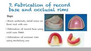 7. Fabrication of record
base and occlusal rims
Steps:
• Block undercuts, relief areas on
final cast with wax
• Fabrication of record base using
cold cure PMMA
• Fabrication of occlusal rims
using modelling wax
 