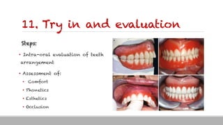 11. Try in and evaluation
Steps:
• Intra-oral evaluation of teeth
arrangement
• Assessment of:
• Comfort
• Phonetics
• Esthetics
• Occlusion
 
