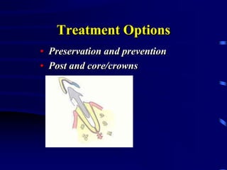 Treatment Options
• Preservation and prevention
• Post and core/crowns
 