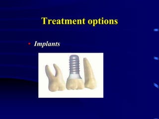 Treatment options
• Implants
 