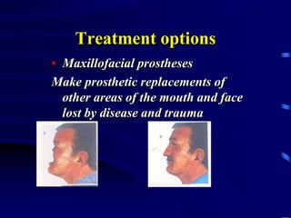 Treatment options
• Maxillofacial prostheses
Make prosthetic replacements of
other areas of the mouth and face
lost by disease and trauma
 