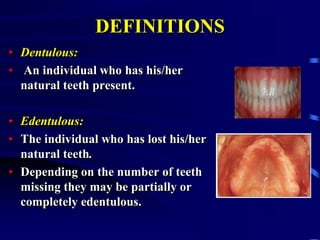 DEFINITIONS
• Dentulous:
• An individual who has his/her
natural teeth present.
• Edentulous:
• The individual who has lost his/her
natural teeth.
• Depending on the number of teeth
missing they may be partially or
completely edentulous.
 
