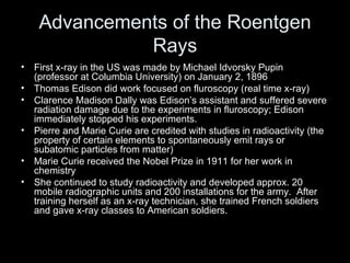 Advancements of the Roentgen Rays <ul><li>First x-ray in the US was made by Michael Idvorsky Pupin (professor at Columbia ...