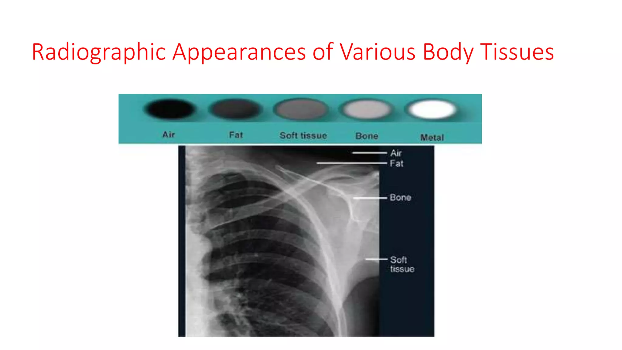 Radiographic Appearances of Various Body Tissues