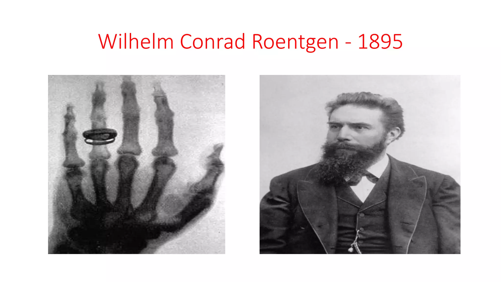 Wilhelm Conrad Roentgen - 1895