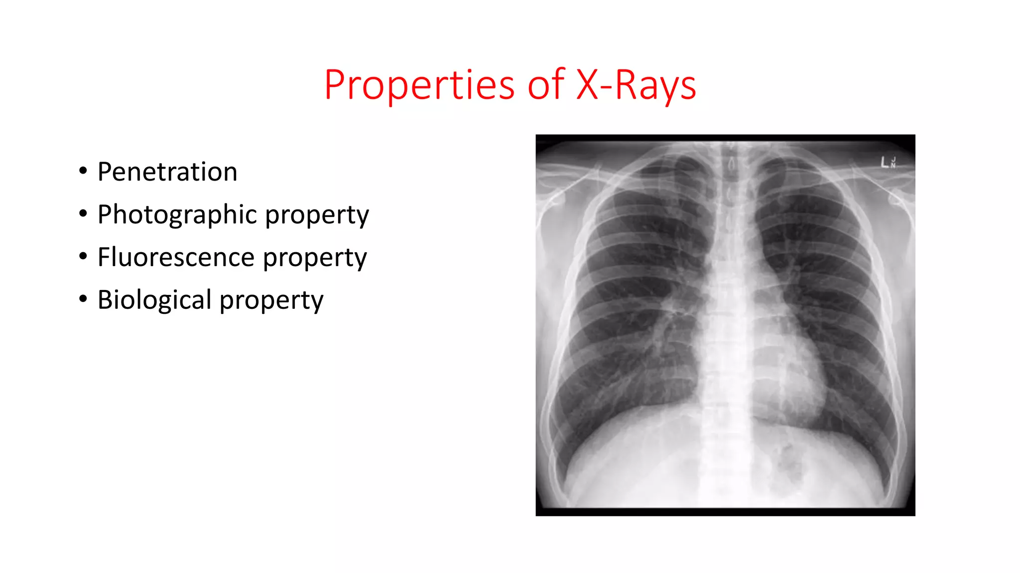 Properties of X-Rays
• Penetration
• Photographic property
• Fluorescence property
• Biological property