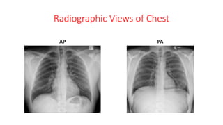 Introduction to radiology | PPTX