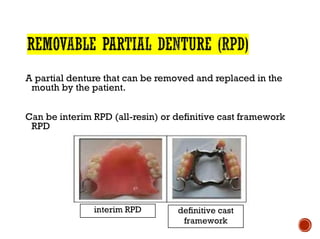 Loading…
A partial denture that can be removed and replaced in the
mouth by the patient.
Can be interim RPD (all-resin) or definitive cast framework
RPD
interim RPD definitive cast
framework
 
