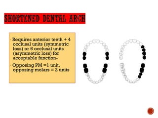 · Requires anterior teeth + 4
occlusal units (symmetric
loss) or 6 occlusal units
(asymmetric loss) for
acceptable function-
· Opposing PM =1 unit,
opposing molars = 2 units
 