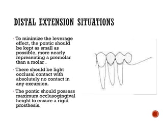 · To minimize the leverage
effect, the pontic should
be kept as small as
possible, more nearly
representing a premolar
than a molar .
· There should be light
occlusal contact with
absolutely no contact in
any excursion.
· The pontic should possess
maximum occlusogingival
height to ensure a rigid
prosthesis.
 