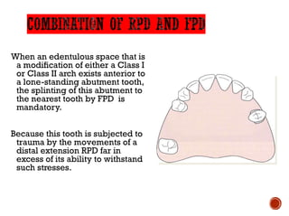 When an edentulous space that is
a modification of either a Class I
or Class II arch exists anterior to
a lone-standing abutment tooth,
the splinting of this abutment to
the nearest tooth by FPD is
mandatory.
Because this tooth is subjected to
trauma by the movements of a
distal extension RPD far in
excess of its ability to withstand
such stresses.
 