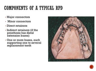 ▪ Major connectors
▪ Minor connectors
▪ Direct retainers
▪ Indirect retainers (if the
prosthesis has distal
extension bases)
▪ One or more bases, each
supporting one to several
replacement teeth
 