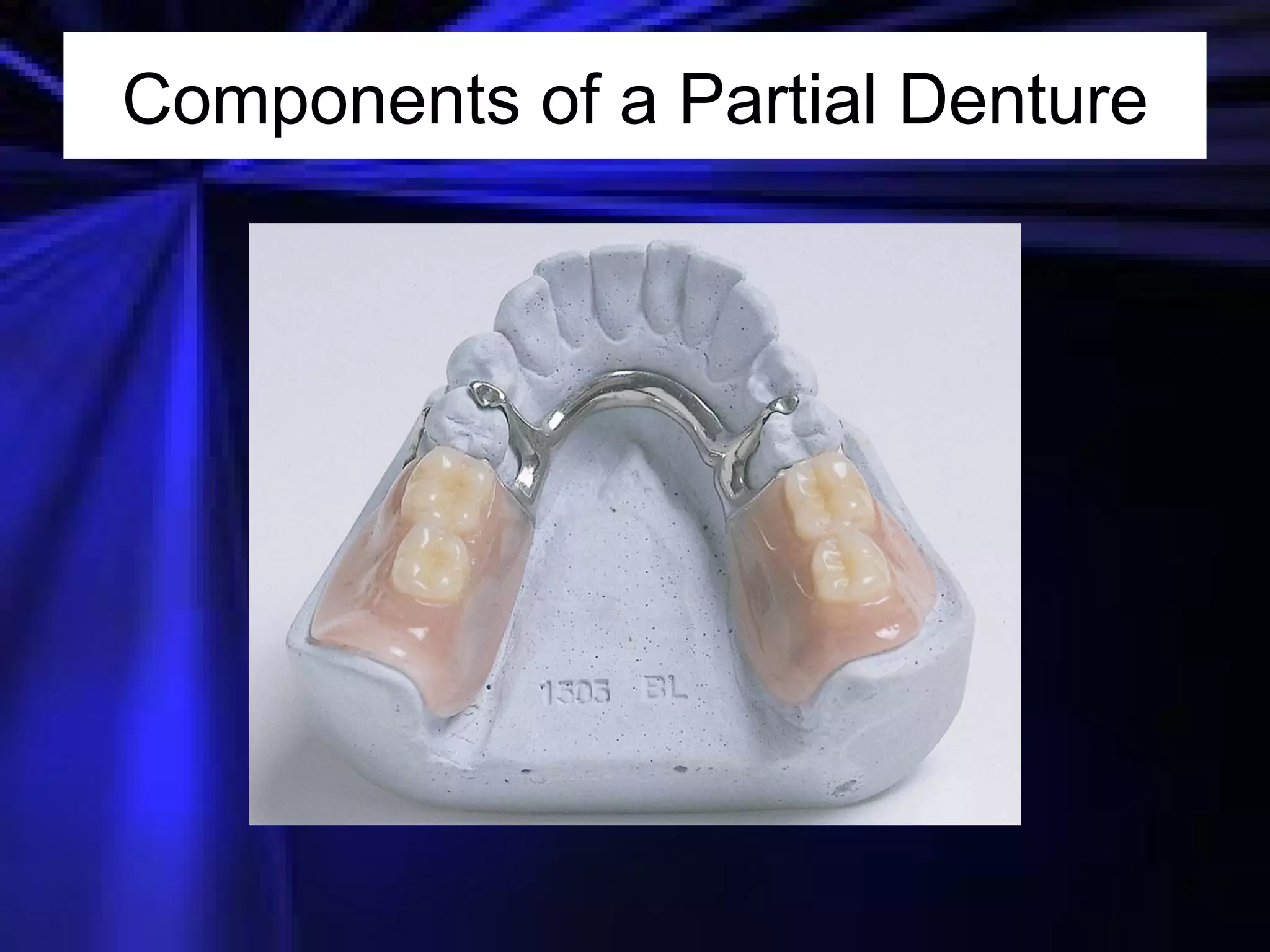 Components of a Partial Denture 