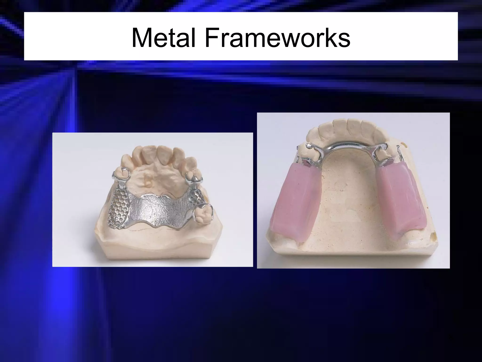 Metal Frameworks 
