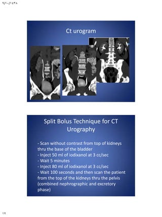 Introduction to renal ct scan | PDF