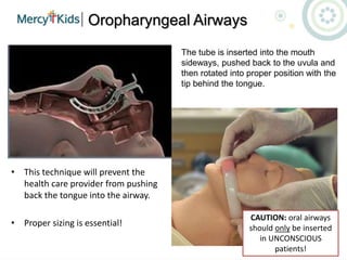 Oropharyngeal Airways
• The tube is inserted into the mouth
sideways, pushed back to the uvula and
then rotated into proper position with the
tip behind the tongue.
• This technique will prevent the
health care provider from pushing
back the tongue into the airway.
• Proper sizing is essential!
CAUTION: oral airways
should only be inserted
in UNCONSCIOUS
patients!
 