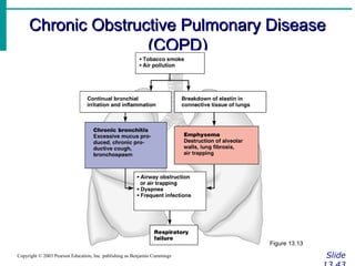 Chronic Obstructive Pulmonary DiseaseChronic Obstructive Pulmonary Disease
(COPD)(COPD)
SlideCopyright © 2003 Pearson Education, Inc. publishing as Benjamin Cummings
Figure 13.13
 